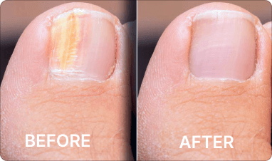 before - after