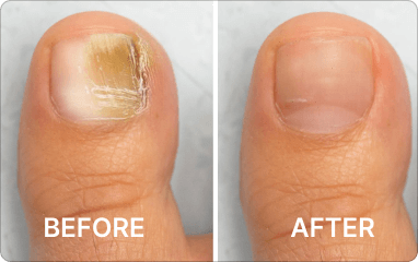before - after